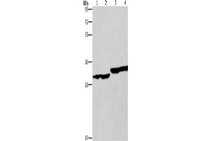 Western Blotting (WB) image for anti-2,4-Dienoyl CoA Reductase 1, Mitochondrial (DECR1) antibody (ABIN2434542) (DECR1 抗体)