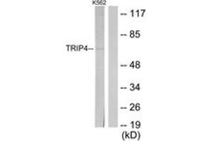 Western blot analysis of extracts from K562 cells, using TRIP4 Antibody. (TRIP4 抗体  (AA 81-130))