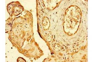 Immunohistochemistry of paraffin-embedded human placenta tissue using ABIN7151194 at dilution of 1:100 (RNF4 抗体  (AA 1-103))