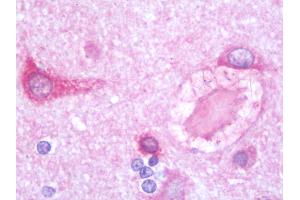 Anti-PSPLA1 / PLA1A antibody IHC staining of human brain, cortex. (PSPLA1 / Phospholipase A1 (C-Term) 抗体)