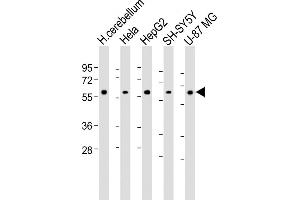 All lanes : Anti-H Antibody (Center) at 1:1000-1:2000 dilution Lane 1: Human cerebellum lysate Lane 2: Hela whole cell lysate Lane 3: HepG2 whole cell lysate Lane 4: SH-SY5Y whole cell lysate Lane 5: U-87 MG whole cell lysate Lysates/proteins at 20 μg per lane. (AMH 抗体  (AA 424-451))