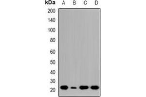 Western blot analysis of NTPCR expression in HCT116 (A), Jurkat (B), COLO205 (C), LO2 (D) whole cell lysates. (C1orf57 抗体  (C-Term))