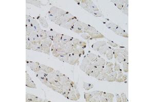 Immunohistochemistry of paraffin-embedded mouse heart using CTCF antibody. (CTCF 抗体)