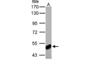 WB Image ABAT antibody detects ABAT protein by Western blot analysis. (ABAT 抗体)
