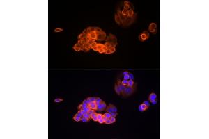 Immunofluorescence analysis of MCF7 cells using MMP13 Rabbit mAb (ABIN7268419) at dilution of 1:100 (40x lens). (MMP13 抗体)