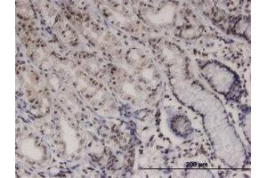 Image no. 1 for anti-PTK6 Protein tyrosine Kinase 6 (PTK6) (AA 342-452) antibody (ABIN599424) (PTK6 抗体  (AA 342-452))