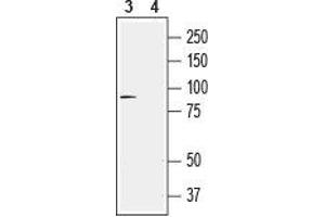 Western blot analysis of rat DRG lysates: - 3. (TRPV4 抗体  (C-Term, Intracellular))