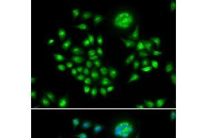 Immunofluorescence analysis of HeLa cells using AGFG1 Polyclonal Antibody (AGFG1 抗体)