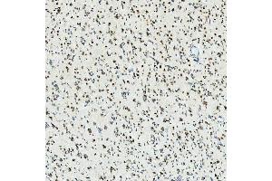 IHC analysis of U1-C/SNRPC using anti-U1-C/SNRPC antibody (ABIN7599016).