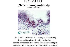 Image no. 1 for anti-Castor Zinc Finger 1 (CASZ1) (N-Term) antibody (ABIN1732691) (CASZ1 抗体  (N-Term))