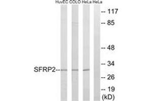 Western blot analysis of extracts from HeLa/COLO/HuvEc cells, using SFRP2 Antibody. (SFRP2 抗体  (AA 119-168))