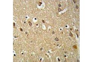 IGF1R antibody IHC analysis in formalin fixed and paraffin embedded brain tissue. (IGF1R 抗体  (AA 51-77))