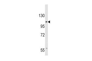 Western blot analysis of CACNA2D3 Antibody (C-term) (ABIN653695 and ABIN2843014) in HepG2 cell line lysates (35 μg/lane). (CACNA2D3 抗体  (C-Term))