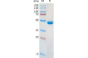 Lectin, Galactoside-Binding, Soluble, 1 (LGALS1) (AA 2-135) protein (Fc Tag)