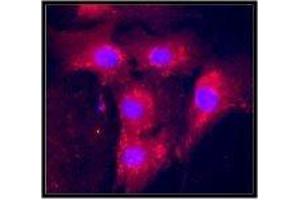 Immunofluorescence staining of paraformaldehyde-fixed primary pig aortic endothelial cells. (VEGF 抗体  (full length))