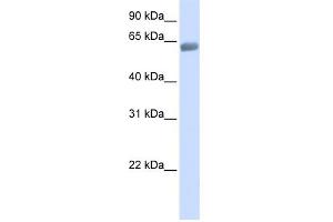 WB Suggested Anti-SLC47A2 Antibody Titration: 0. (SLC47A2 抗体  (C-Term))
