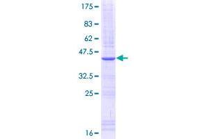 Image no. 1 for Interleukin 15 Receptor, alpha (IL15RA) (AA 31-130) protein (GST tag) (ABIN1307699)