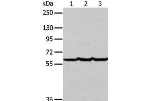 Western Blot analysis of Human liver cancer tissue, hela and Jurkat cell using Factor IX Polyclonal Antibody at dilution of 1:400 (Coagulation Factor IX 抗体)