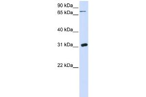 WB Suggested Anti-UPP1 Antibody Titration:  0. (UPP1 抗体  (N-Term))