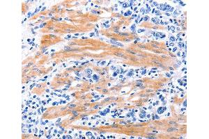 Immunohistochemistry (IHC) image for anti-Growth Differentiation Factor 9 (GDF9) (AA 205-454) antibody (ABIN3016573) (GDF9 抗体  (AA 205-454))