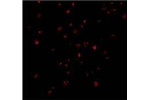 Immunofluorescence of IRE1p in A20 cells with AP30444PU-N IRE1p antibody at 2 ug/ml. (ERN1 抗体  (C-Term))