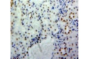 Used in DAB staining on fromalin fixed paraffin-embedded Kidney tissue