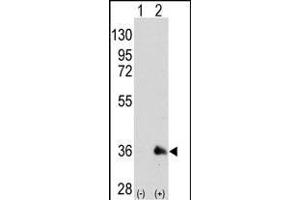 Western blot analysis of SOX2 (arrow) using mouse monoclonal SOX2 antibody (ABIN387798 and ABIN2843854). (SOX2 抗体)