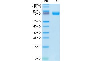 Human FGFR2 beta (IIIb) on Tris-Bis PAGE under reduced conditions.