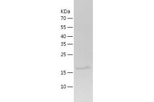 Western Blotting (WB) image for Adrenergic, alpha-2B-, Receptor (ADRA2B) (AA 202-370) protein (His tag) (ABIN7282293) (ADRA2B Protein (AA 202-370) (His tag))