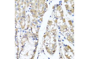 Immunohistochemistry of paraffin-embedded human gastric using TNFAIP6 antibody at dilution of 1:100 (x40 lens). (TNFAIP6 抗体)