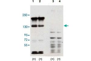Western blot using Sipa1 polyclonal antibody  shows detection of over-expressed Sipa1 in lysates from mouse NIH/3T3 cells transfected with Sipa1 (Lane 1). (SIPA1 抗体  (N-Term))