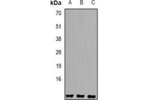 Western blot analysis of Sm E expression in A549 (A), K562 (B), HepG2 (C) whole cell lysates.