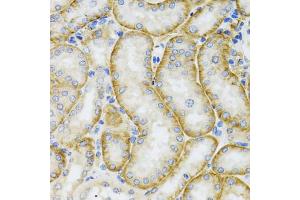 Immunohistochemistry of paraffin-embedded mouse kidney using ARFGAP1 antibody (ABIN5974280) at dilution of 1/100 (40x lens). (ARFGAP1 抗体)