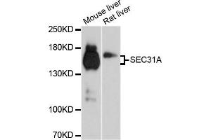 Western blot analysis of extracts of mouse liver and rat liver cell lines, using SEC31A antibody. (SEC31A 抗体)