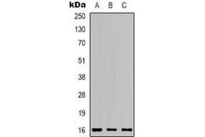 Western blot analysis of Apelin expression in 22RV1 (A), MCF7 (B), mouse brain (C) whole cell lysates. (Apelin 抗体  (C-Term))