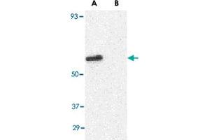 Western blot analysis of GPR44 in Jurkat cell lysate with GPR44 polyclonal antibody  at 1 ug/mL in (A) the absence and (B) presence of blocking peptide. (Prostaglandin D2 Receptor 2 (PTGDR2) (N-Term) 抗体)