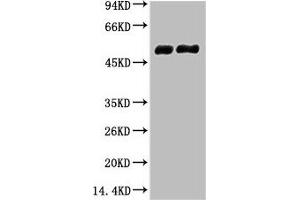 Western blot analysis of 1) Mouse Brain tissue, 2) Rat Brain tissue, diluted at 1:100000. (TUBB2A 抗体)