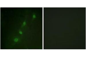 Immunofluorescence analysis of HeLa cells, using SGK (Ab-78) Antibody. (SGK1 抗体  (AA 41-90))