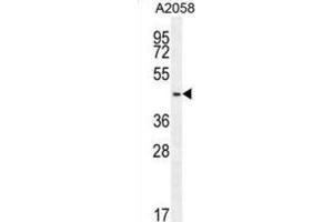 Western Blotting (WB) image for anti-DDB1 and CUL4 Associated Factor 4-Like 2 (DCAF4L2) antibody (ABIN2995734) (DCAF4L2 抗体)