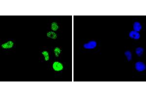 HeLa cells were fixed in paraformaldehyde, permeabilized with 0. (C-JUN 抗体)