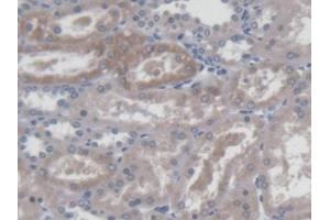 DAB staining on IHC-P; Samples: Human Kidney Tissue (TASP1 抗体  (AA 234-420))