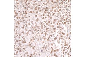 Immunohistochemistry (IHC) image for anti-Protein Arginine Methyltransferase 1 (PRMT1) (AA 1-50) antibody (ABIN7453933) (PRMT1 抗体  (AA 1-50))