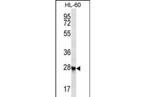 C Antibody (N-term) (ABIN656356 and ABIN2845654) western blot analysis in HL-60 cell line lysates (35 μg/lane). (Chromosome 12 Open Reading Frame 52 (C12orf52) (AA 44-72), (N-Term) 抗体)
