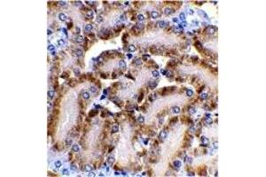 Immunohistochemistry (IHC) image for anti-Carbamoyl-Phosphate Synthetase 2, Aspartate Transcarbamylase, and Dihydroorotase (CAD) (Middle Region) antibody (ABIN1030894) (CAD 抗体  (Middle Region))