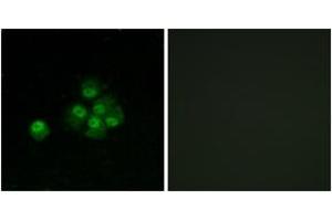Immunofluorescence (IF) image for anti-Insulin Receptor Substrate 1 (IRS1) (pSer636) antibody (ABIN2888449) (IRS1 抗体  (pSer636))