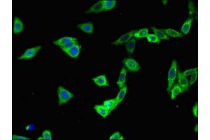 Immunofluorescent analysis of HepG2 cells using ABIN7163637 at dilution of 1:100 and Alexa Fluor 488-congugated AffiniPure Goat Anti-Rabbit IgG(H+L) (PLEKHA7 抗体  (AA 294-654))