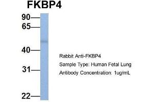 Host:  Rabbit  Target Name:  FKBP4  Sample Type:  Human Fetal Lung  Antibody Dilution:  1. (FKBP4 抗体  (C-Term))