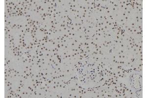 ABIN6257812 and ABIN6273635 at 1/100 staining Rat kidney tissue by IHC-P. (HSPB3 抗体  (Internal Region))