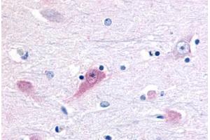 Anti-ROR Beta antibody  ABIN1049295 IHC staining of human brain, thalamus. (RORB 抗体  (Ligand Binding Domain))