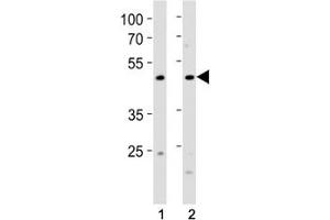 Western Blotting (WB) image for anti-Forkhead Box A2 (FOXA2) (AA 380-407) antibody (ABIN3030983)